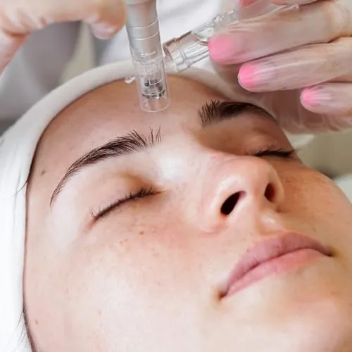 Summer Repair (dermaplaning + microneedling con Exosomas)