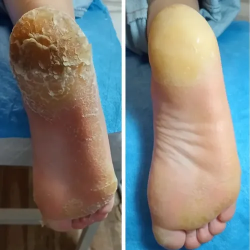 Podología Estética 