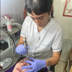 Limpieza + microneedling con exosomas