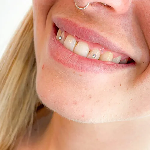 GEMA DENTAL 2x1