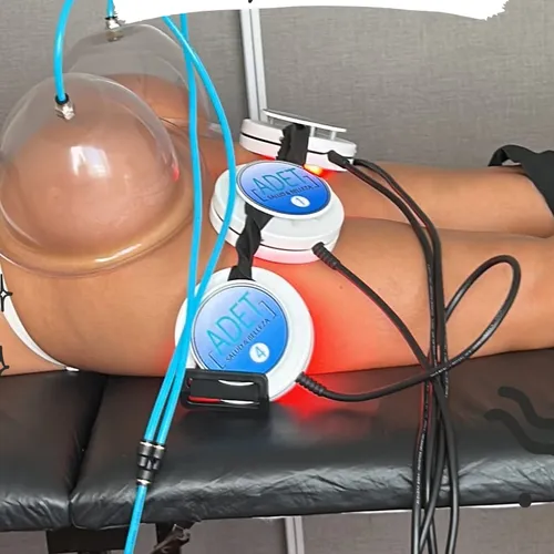 Full Celulitis