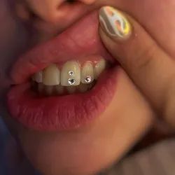 Gema dental swarovski c/u