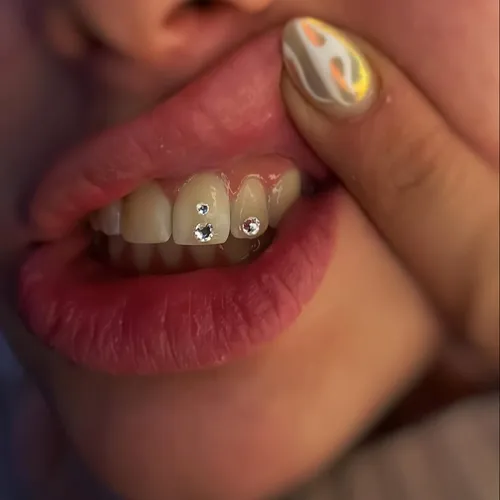 Gema dental swarovski c/u