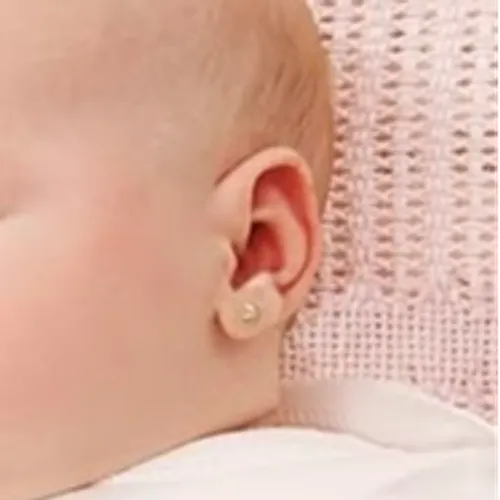 Aros bebas