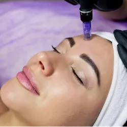 Higiene + dermapen/microneedling