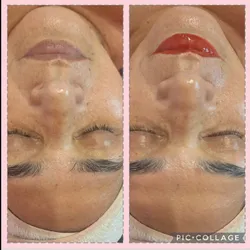 Tratamiento Facial Premium