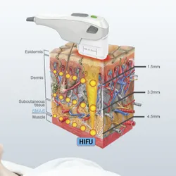 HIFU Facial