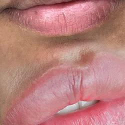 Remocion de cejas y labios - New 2026