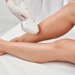 Depi láser Piernas Completas