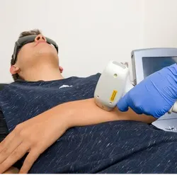 Depi Láser Medio Brazo