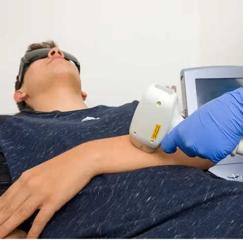Depi Láser Medio Brazo