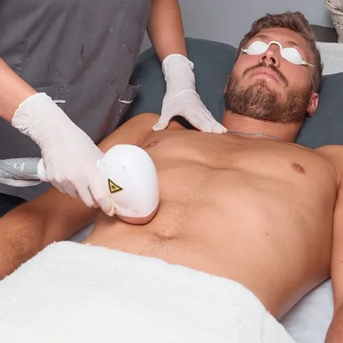 Depi Láser Abdomen