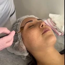 Tratamientos Faciales 