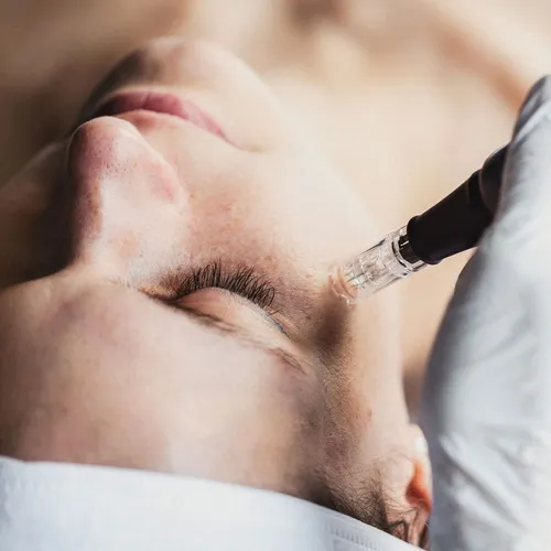 Dermapen con Exosomas