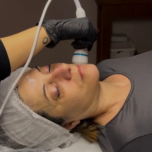 Higiene profunda + radiofrecuencia 