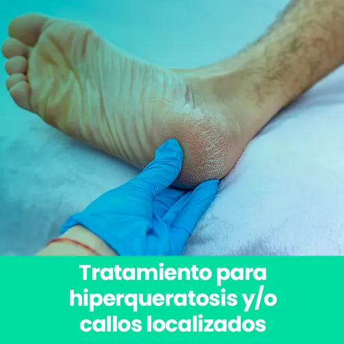 Tratamiento para hiperqueratosis y/o callos localizados