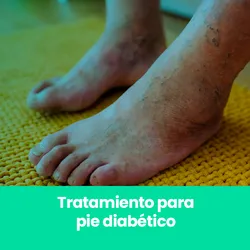 Tratamiento para pie diabético