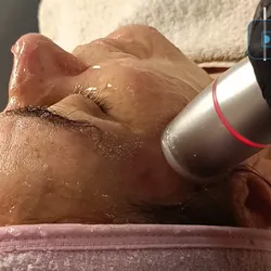 Higiene Antiage Reafirmante (con Radiofrecuencia)