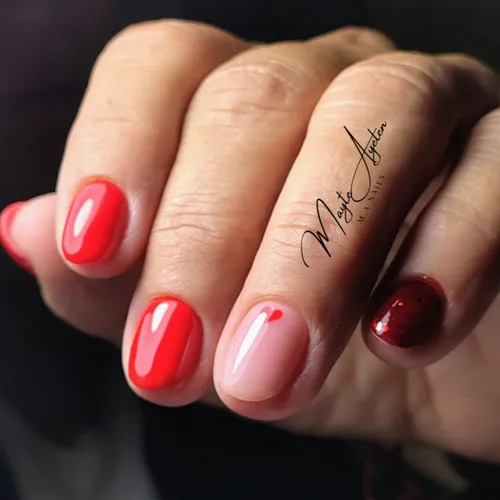 Kapping en gel