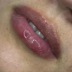 Hidragloss