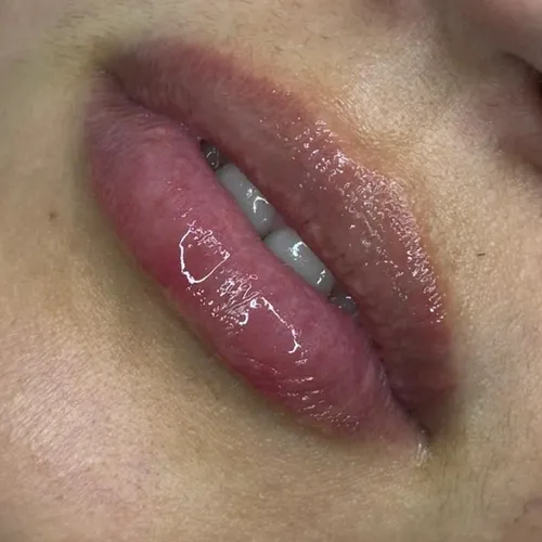 Hidragloss