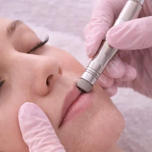 Punta de diamante facial