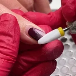Remoción de esmaltado o kapping 