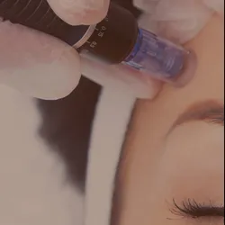 Limpieza facial + Dermapen