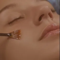 Peeling químico - PACK 4 SESIONES