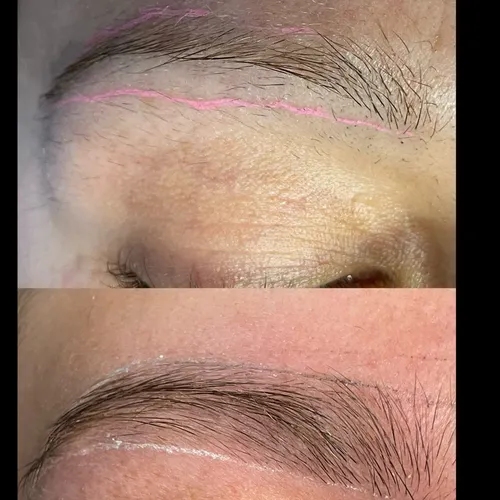 Sesión reconstrucción de Cejas