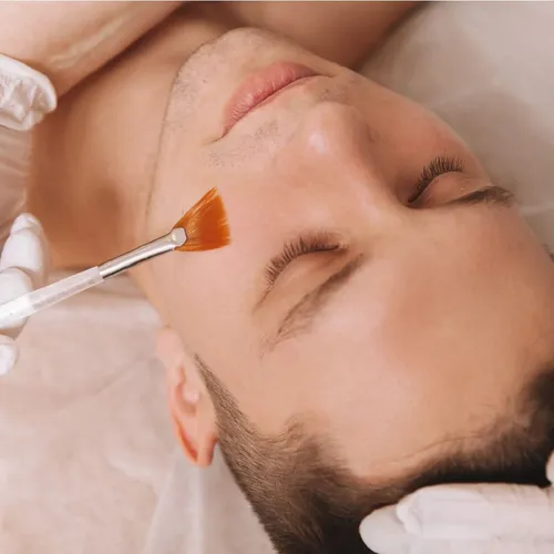 PEELING QUÍMICO
