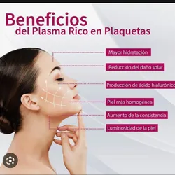 Plasma rostro