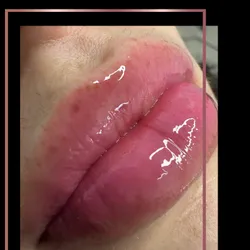 Hidragloss