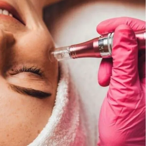 Microneedling con exosomas