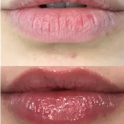 Lips Glow