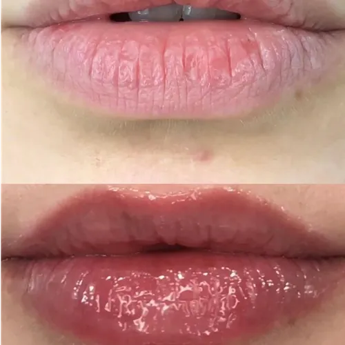 Lips Glow