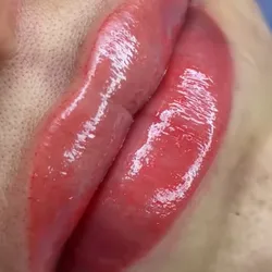  Neutralización de Labios