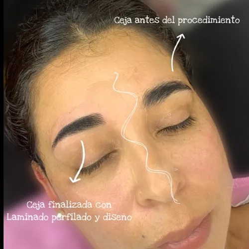 PERFILADO