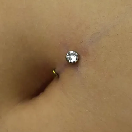 Floating navel (ombligos hondos con pliegue)