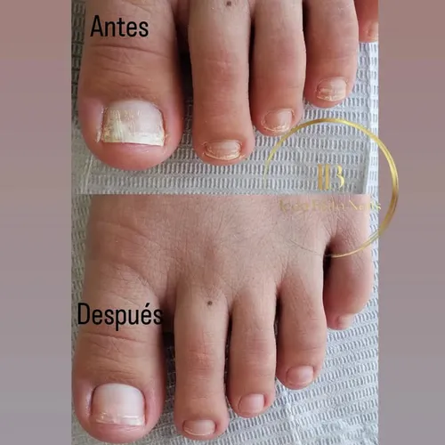 Belleza de pies - sin esmalte 