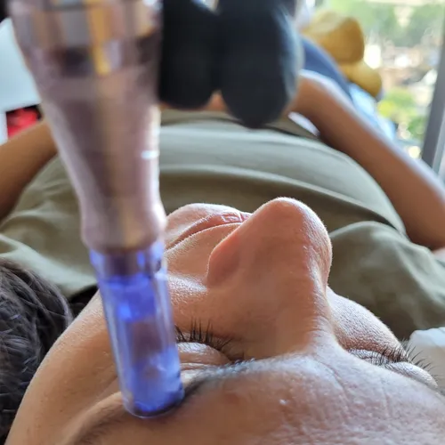Reconstrucción de cejas | Tacuarembó