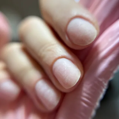 Retirado + turno 