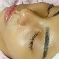 Limpieza profunda (alta frecuencia) + bioestimuladores 🤴