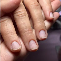 Retiro de uñas 