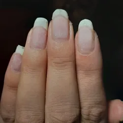 Retiro de soft gel