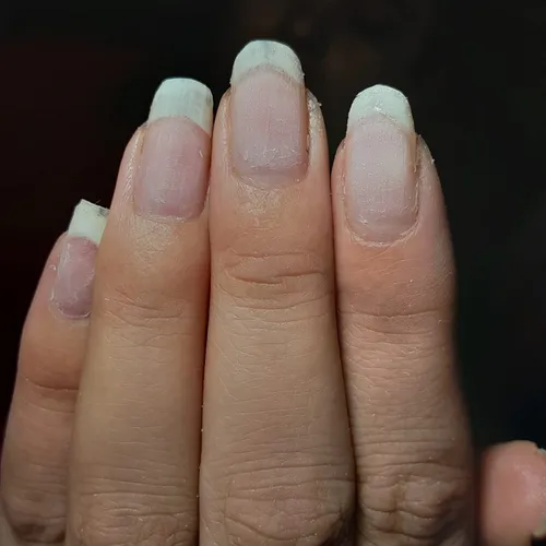 Retiro de soft gel