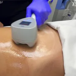 Exilis corporal
