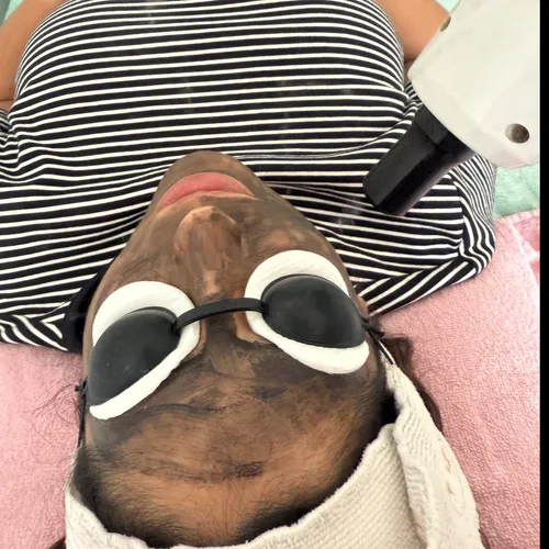 Hollywood peel