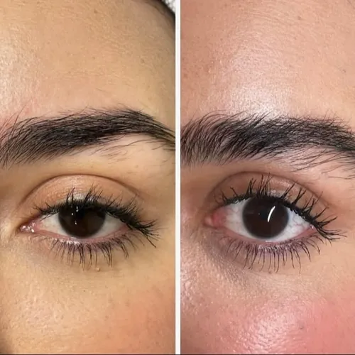 Brow booster: bioestimulación de crecimiento de cejas