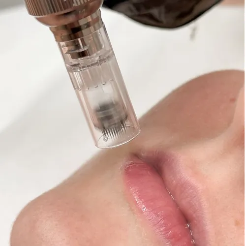 · Dermapen Renovage + Hydralips